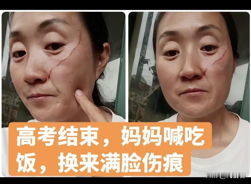 简直就是白眼狼！一位妈妈在网上哭诉，自己被亲女儿打了！

高考结束后，妈妈想给女