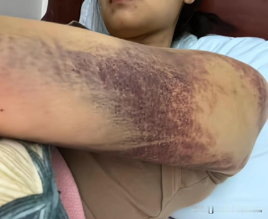 家暴好可怕，军埠莲坛村2025年11月1日，一名女子被丈夫用水管殴打，丈夫还存在