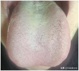 心阳一灭，肾欲先绝，补肾不补心，再多的补药都是竹篮打水
患者主诉：那方面想法减少