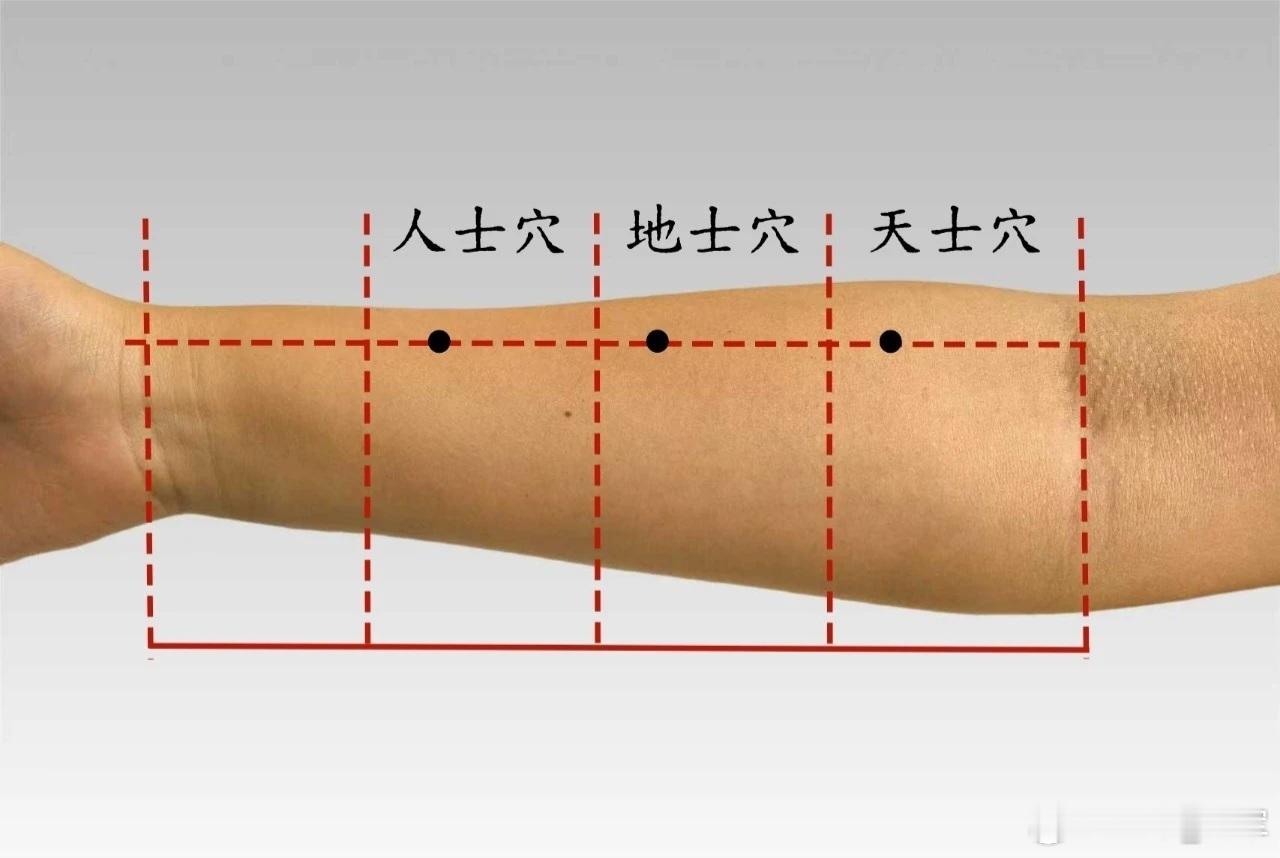 气喘、心脏病、手掌手指痛，人士穴 人士穴源自董氏奇穴位置：在前臂桡骨里侧，距腕横