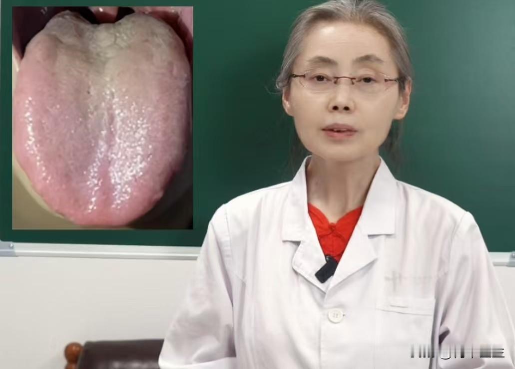 这样的舌头千万别盲目补了，否则只会火上浇油！

患者主诉：那方面时间短，总是早早