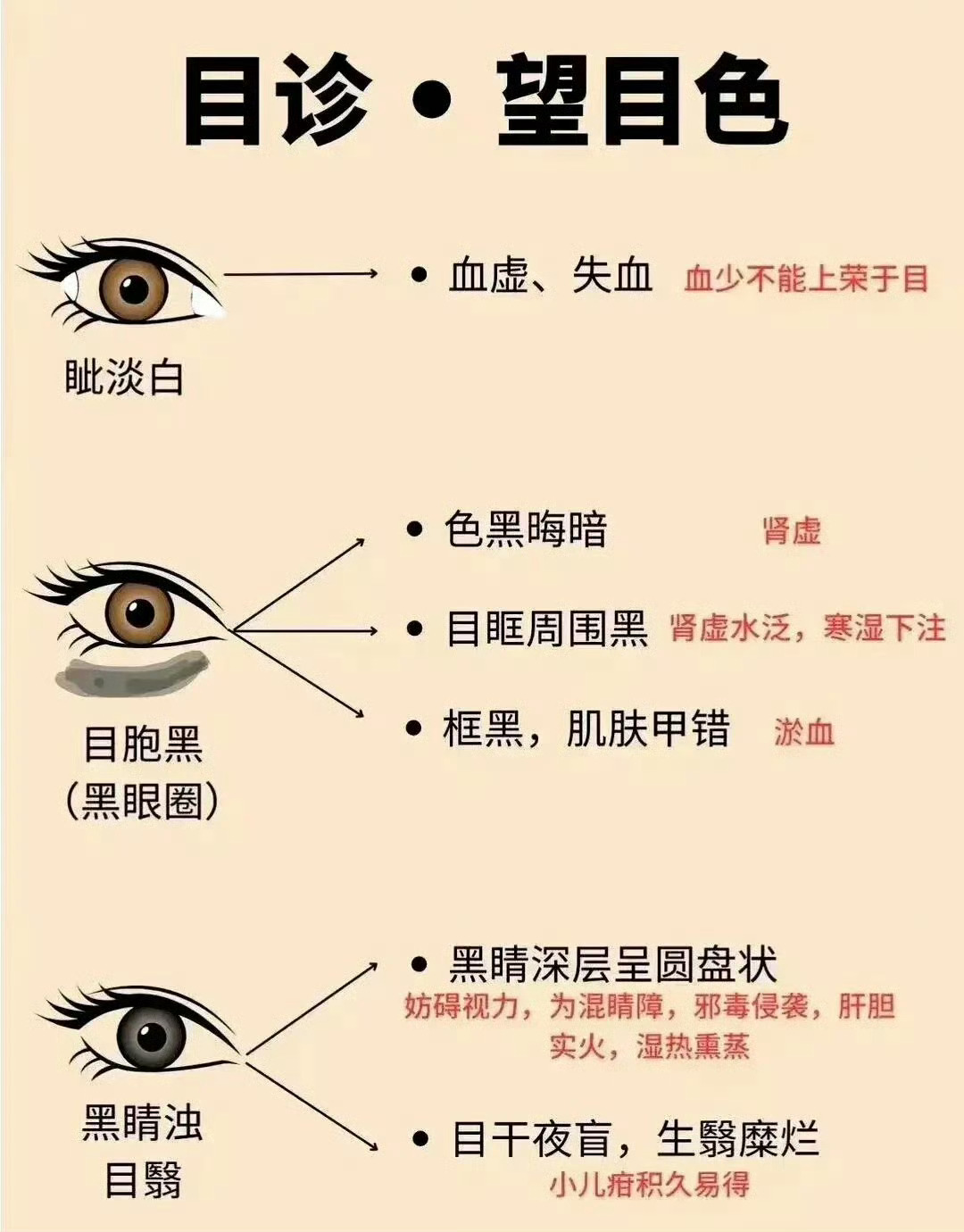 中医目睛五轮歌诀||中医目睛五轮歌诀 ​​​