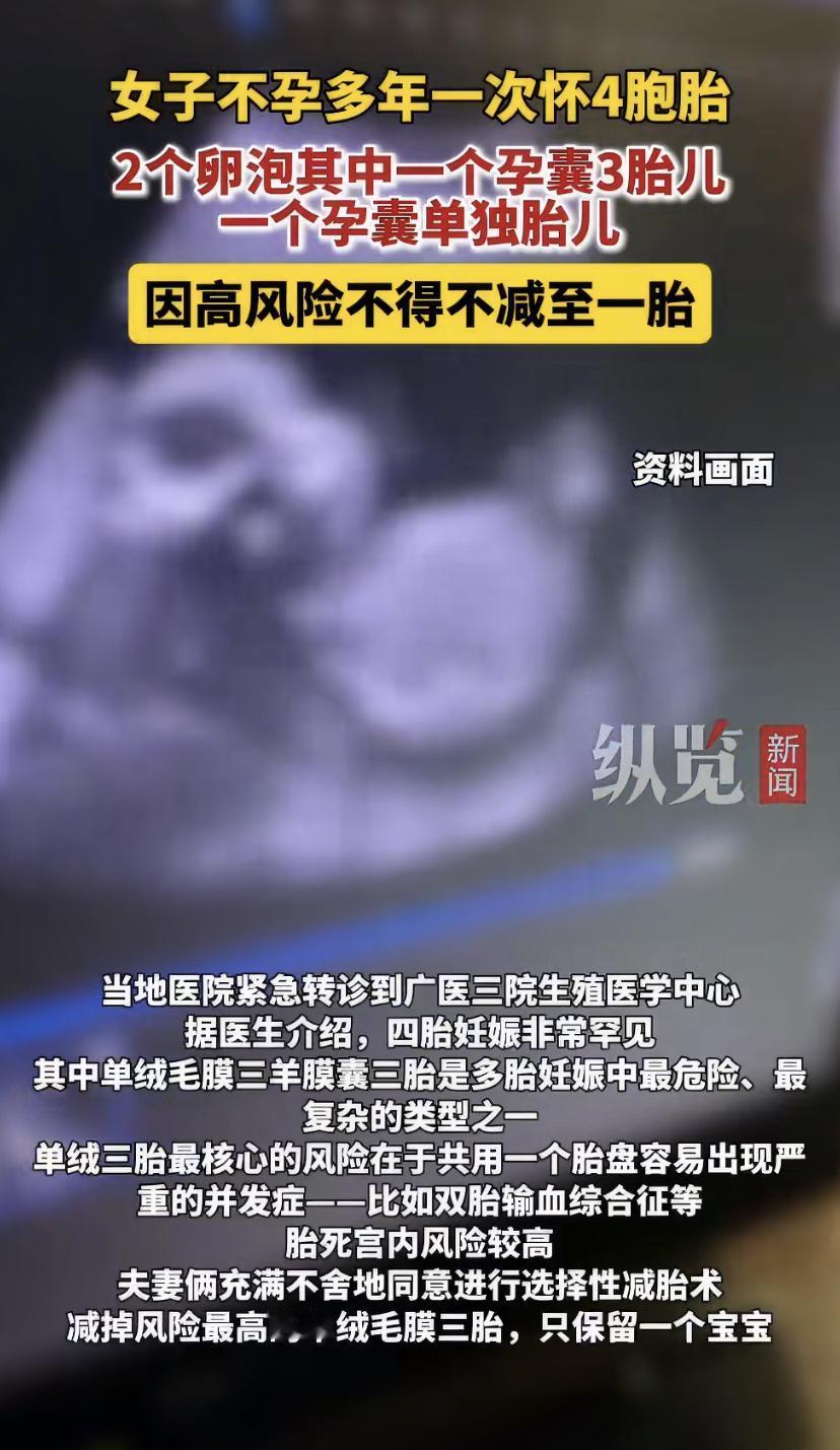 广州的程女士因为多年怀不上孩子，一直很痛苦。最近她做了促排卵治疗，终于怀上了!全