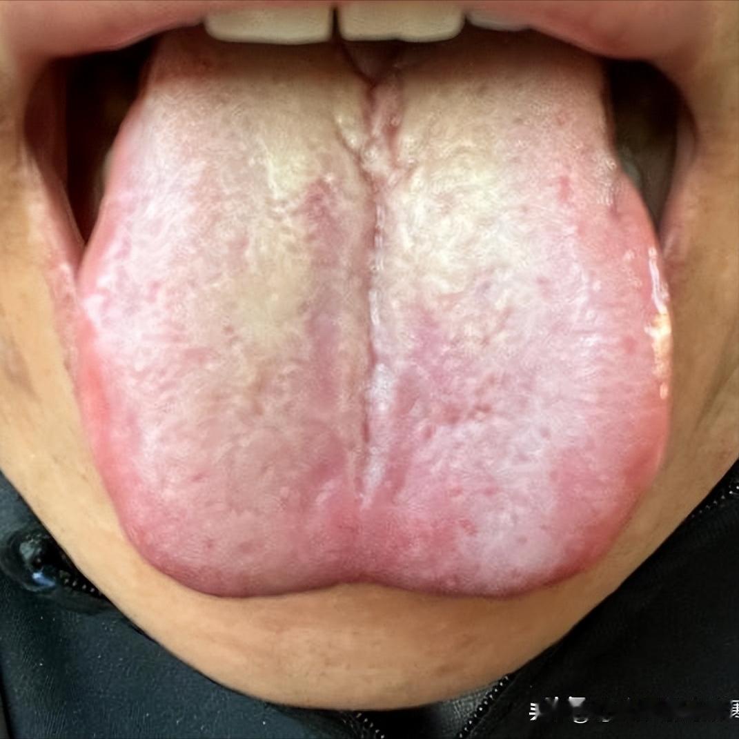 这个粉丝才30岁，头发都快掉光了，来的时候站都站不稳[吃瓜群众][吃瓜群众]
还