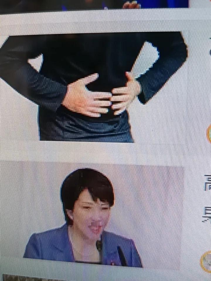 乙状结肠息肉形成原因挺复杂，目前还没完全明确。遗传方面，像家族性腺瘤性息肉病，有