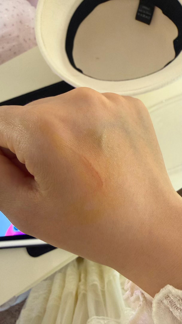 每次没睡好想说顶一顶把这点活干完，就会莫名给自己来一道口子。简直匪夷所思，有时是
