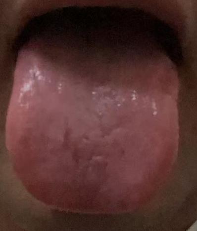 肾阳不足精力差？中医调理提升身体机能







从中医的角度看，男性要想正常