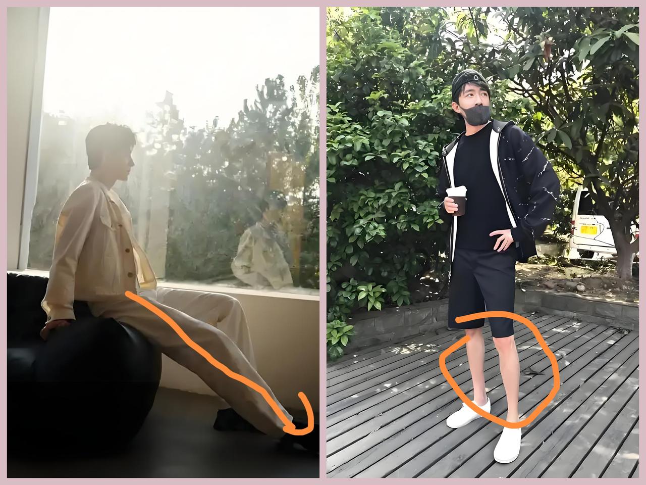 谁说大长腿是女生的专利
可不是吗？
俞灏明曾参加某品牌秀场 “搞怪走秀” 被赞 