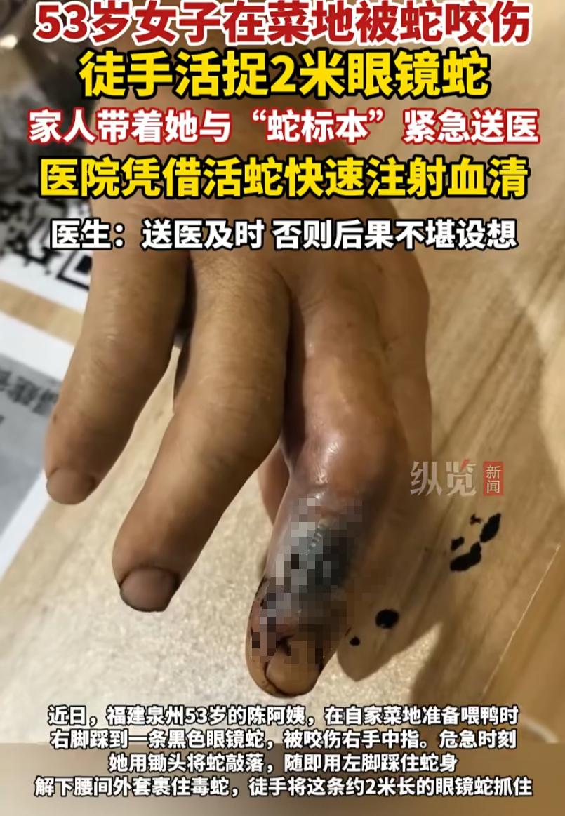 福建泉州，一位阿姨在自家地里干活，突然被一条2米的眼镜蛇咬伤手指，没想到，阿姨反