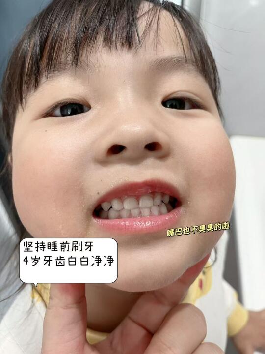 宝宝4岁没有蛀牙，分享自用儿童牙膏