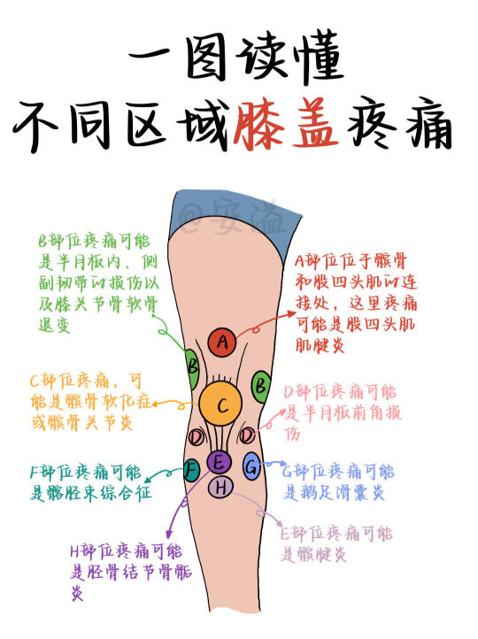 医学生绘本‖一图读懂不同部位膝盖痛