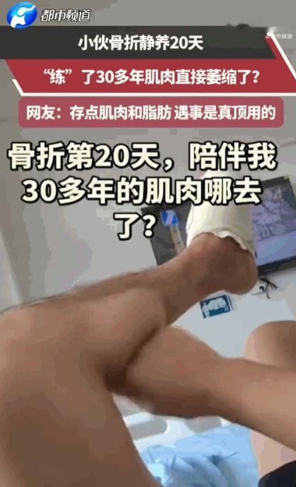 万万没想到！河南一小伙骨折后躺床静养，不料短短20天，练了30年的精壮小腿竟萎缩