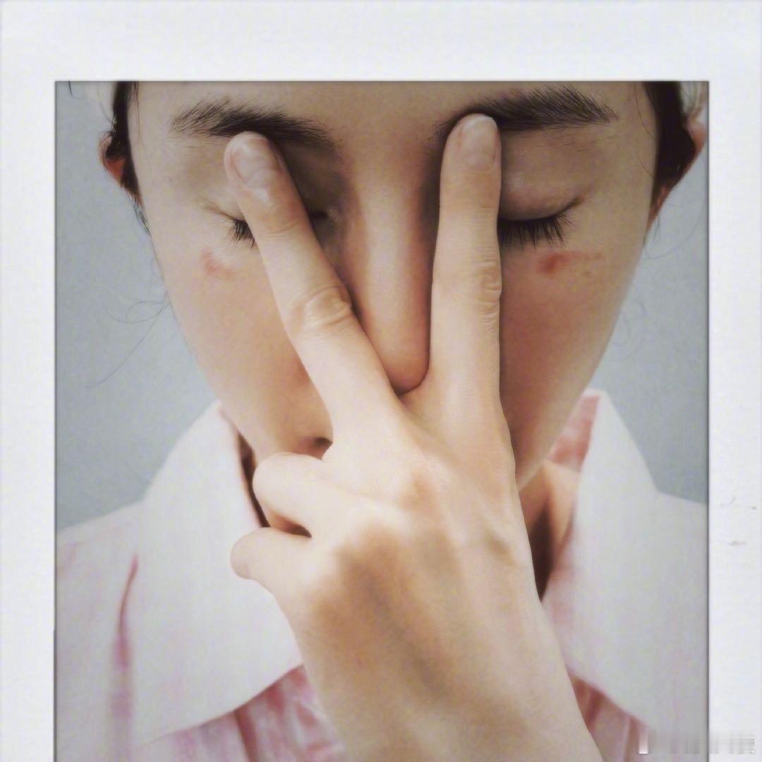 2026年4月27日晚，演员杨幂在其个人社交平台发布动态，晒出眼部下方带有清晰红