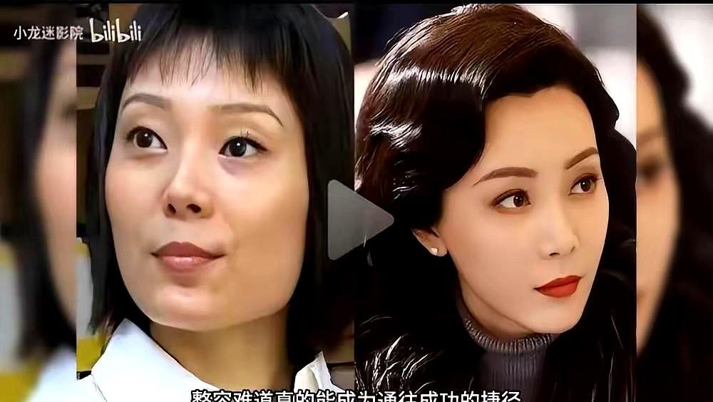 看到陈数那几张对比照，突然就理解了什么叫“有钱才有资格变好看”。
从凸嘴、大腮帮