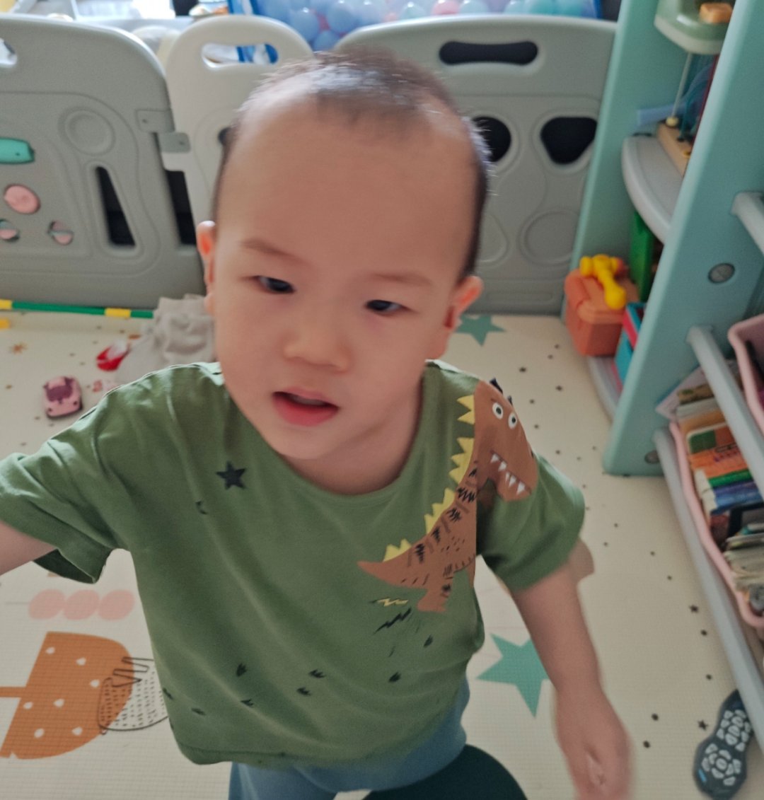 孩子头发长得不好，来医院开个药 ​​​