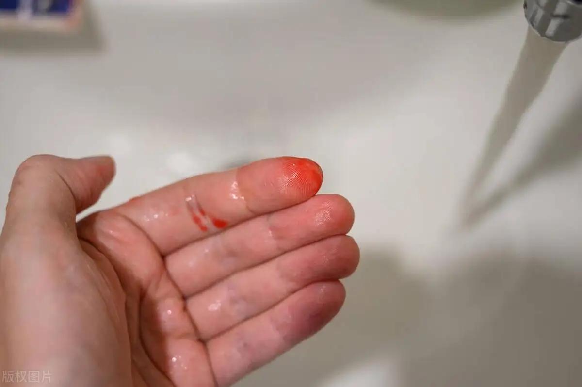 围绝经期异常出血，别让“小信号”拖成“大悲剧”！
围绝经期的身体信号从不是小事，