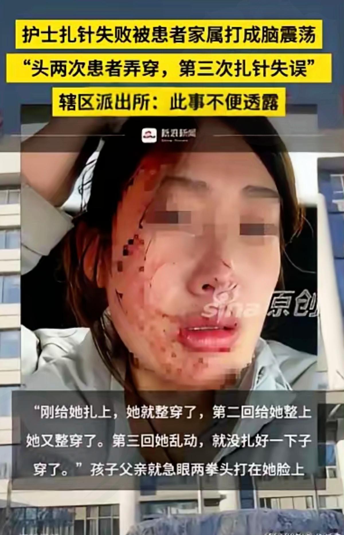 看完秦皇岛这事儿真的气炸！
护士连续给小女孩扎针三次没成，竟被家长两拳打成重伤，