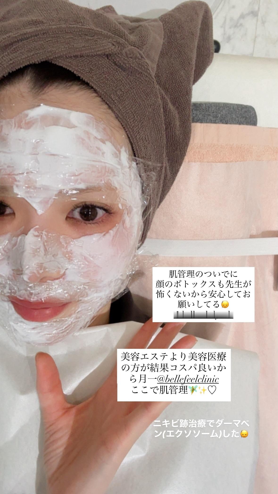 松平璃子「圧倒的、冬派⛄️」 