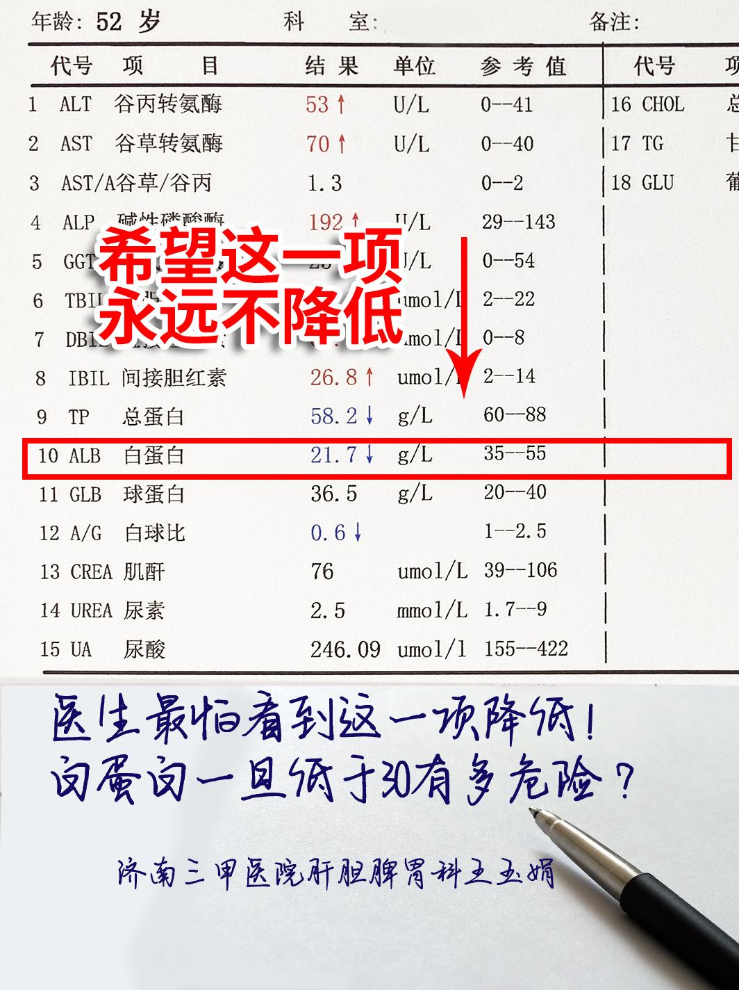 大家看这位山东患者的肝功能报告单，转氨酶和胆红素都异常，白蛋白低于21...