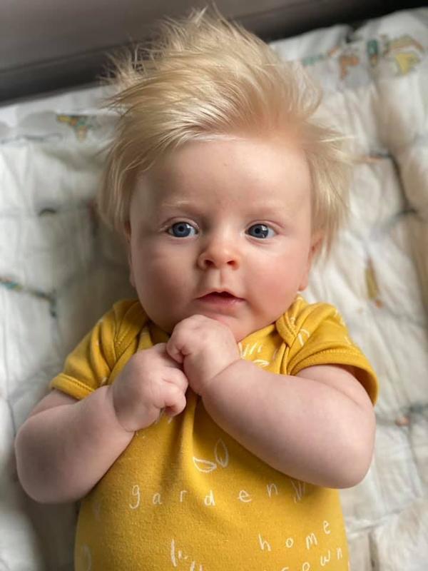 我还真见过天生发色是金色的人。天生金发由遗传基因控制，毛囊黑素细胞主要合成褐黑色