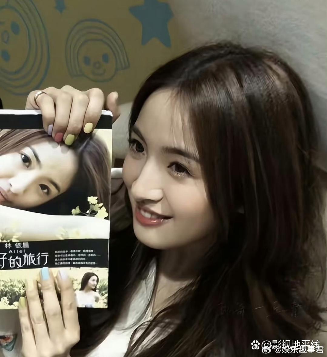 林依晨称因熬夜和压力患脑部囊肿近日，演员林依晨在视频播客节目中表示，2009年的