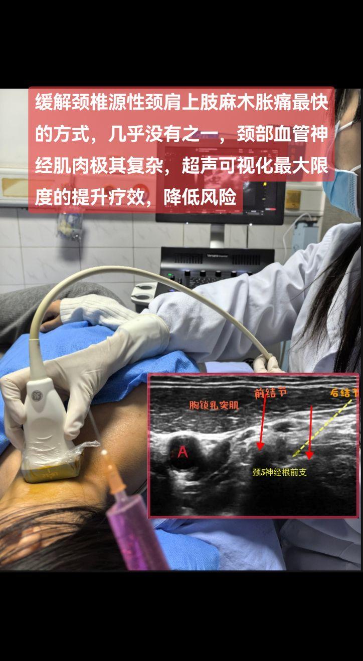 “神经根型颈椎病”表现为颈肩部僵硬酸胀痛伴上肢放射痛麻木，以物理治疗及...