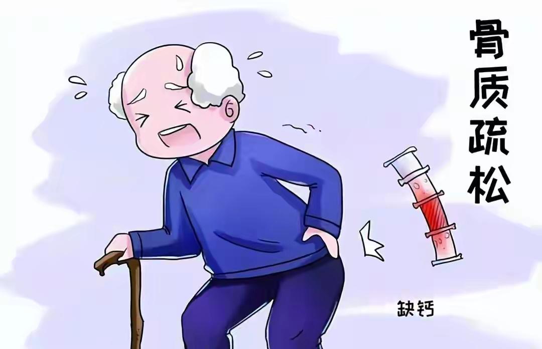 我国有上千万人做骨密度检测！医生：查一次骨密度，或管十年无碍
在这个快节奏、压力