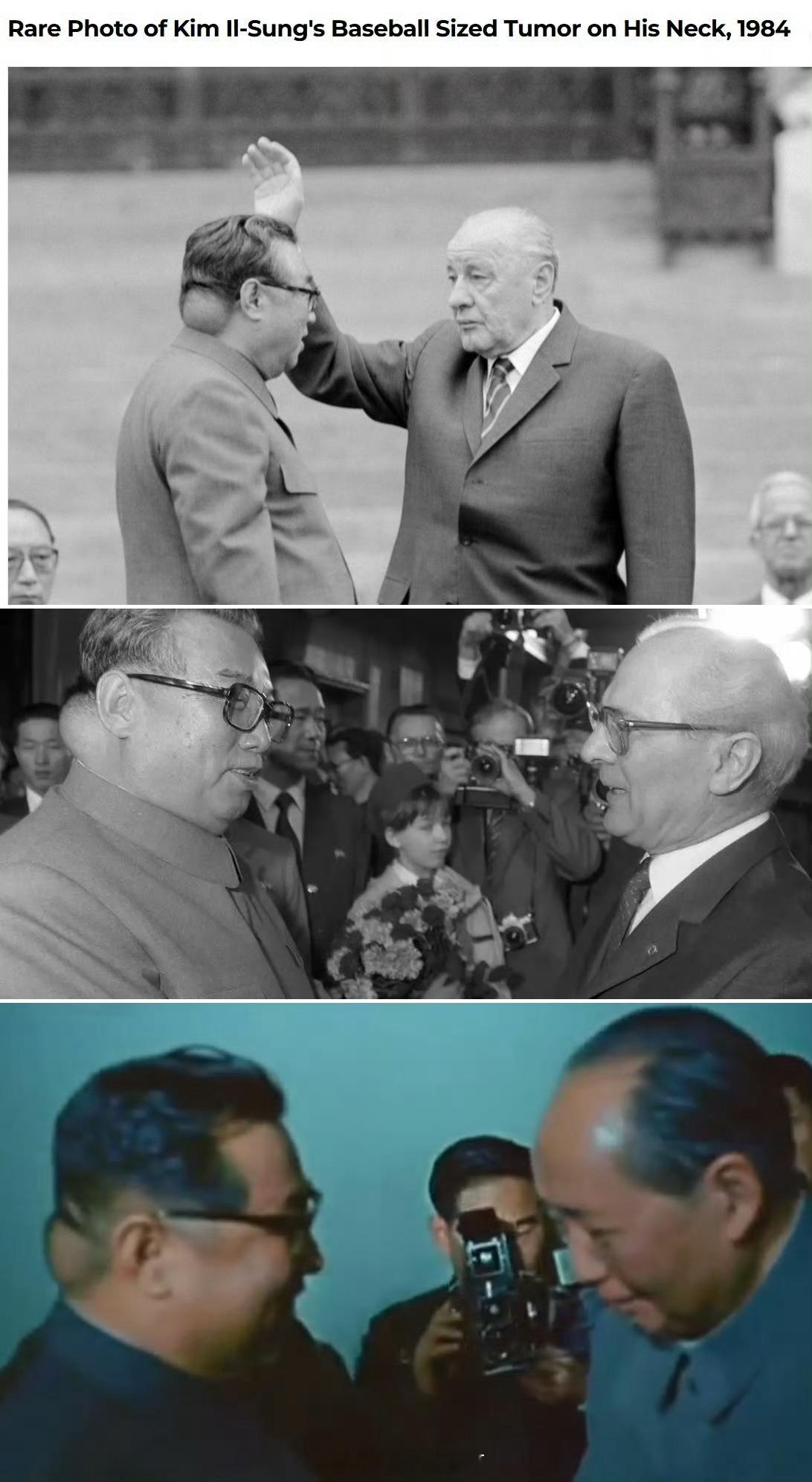 原来大太阳右后脑一个大包啊，囊肿吗？外国记者拍起照来可没有曹县国内记者那么懂政治