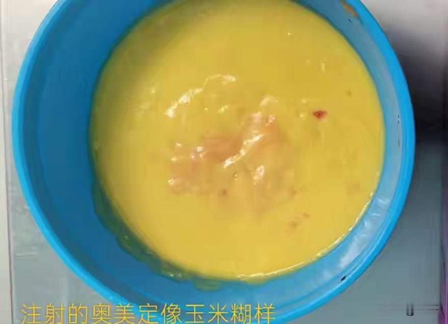 惊悚！女子胸部取出一团“玉米糊”，这款隆胸手术20年前就明令叫停，很多女性还在硬