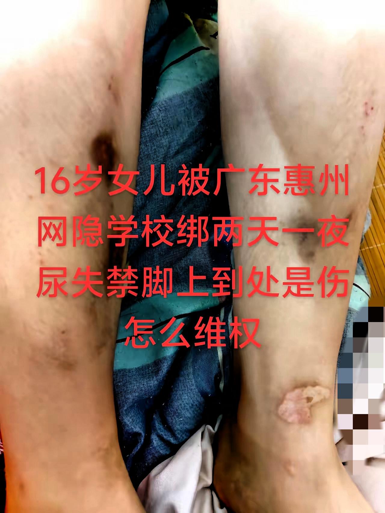 刷到16岁女孩遭教官欺凌绑架！家长维权别慌，这几步才是关键！
 
太让人心疼又愤