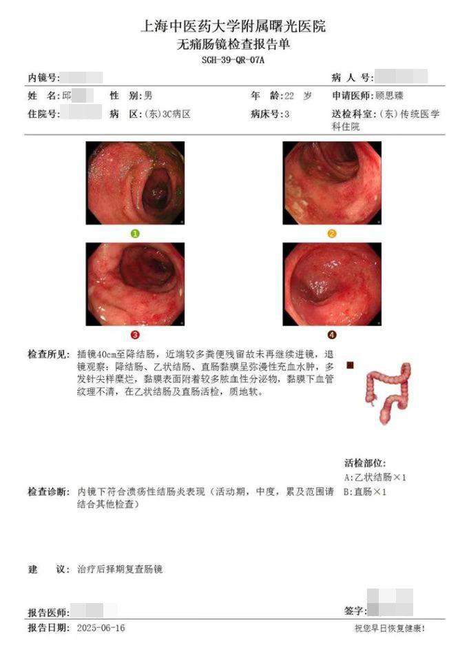 一位危重溃结患者的启示！！。5个月，从爆发性便血到肠黏膜基本愈合：一位...