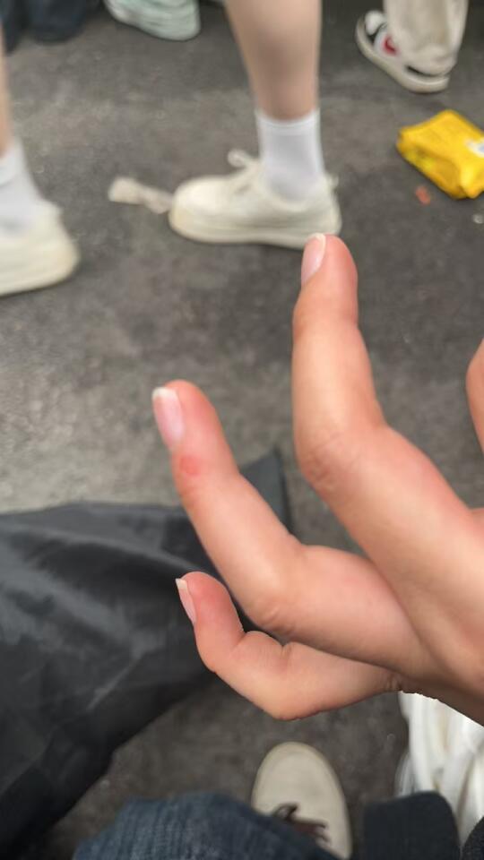 长沙好六同担的手都被掐伤了❗️