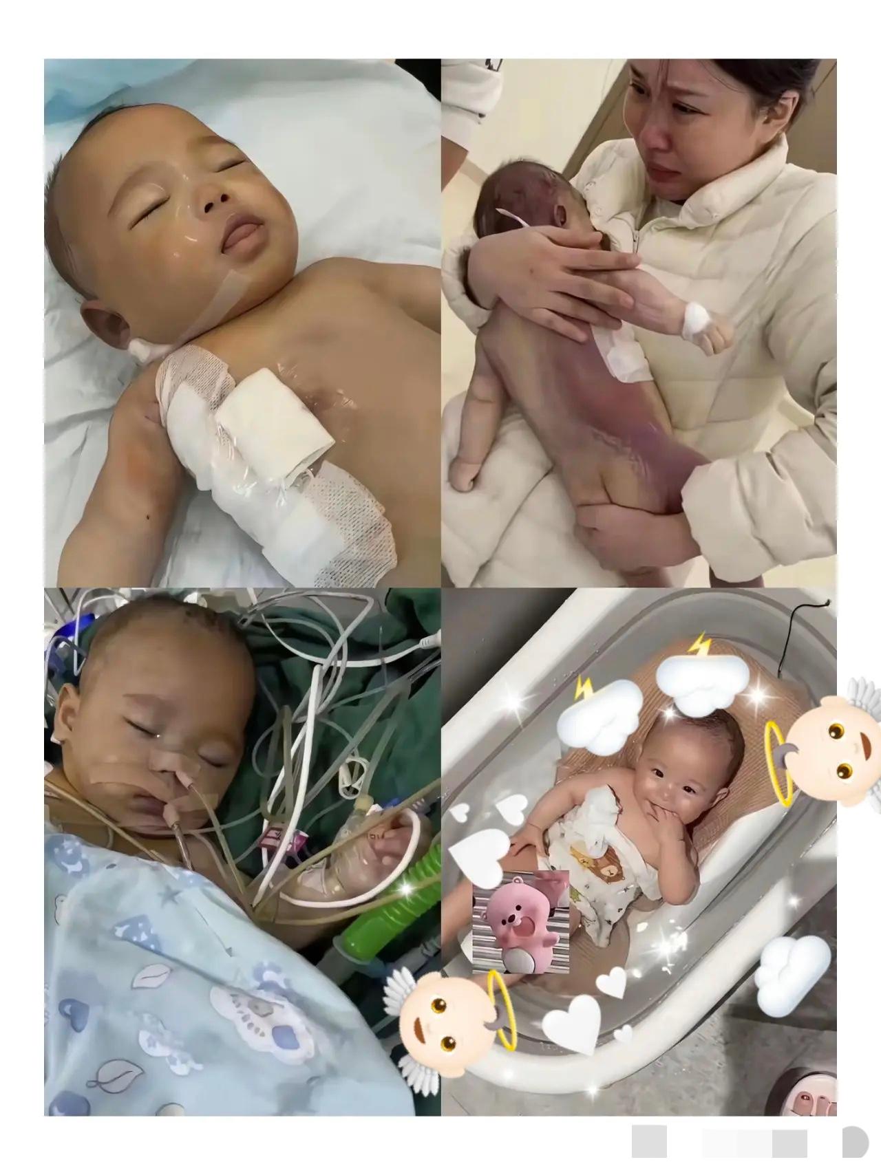 太揪心！宁波5个月早产宝宝手术台离世，医生的话真能全信吗？

早产儿常见的房间隔