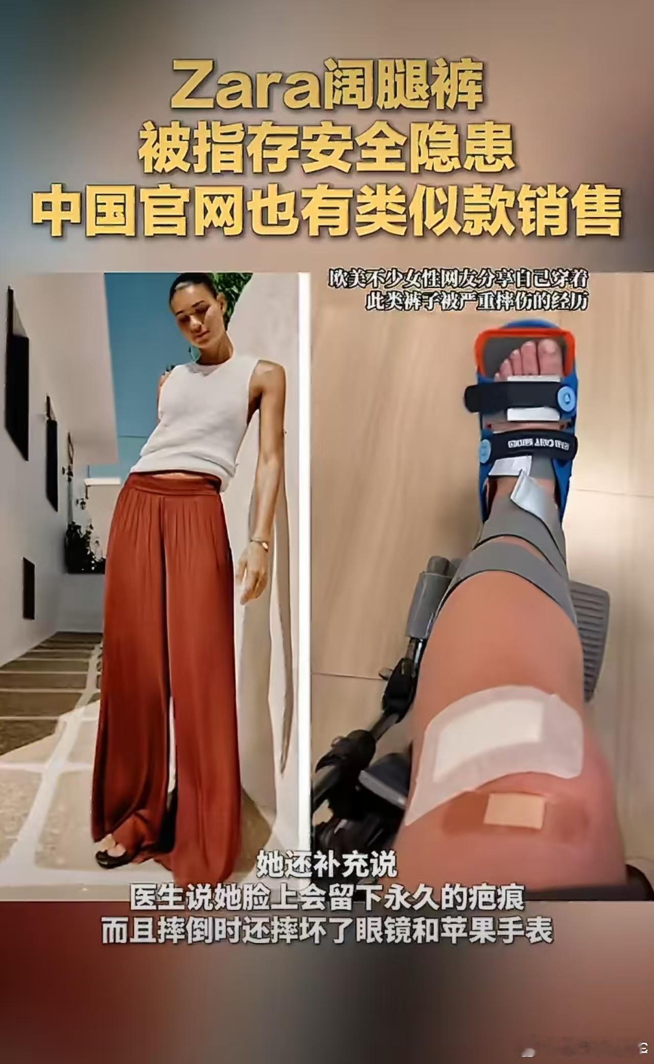 Zara阔腿裤存安全隐患Zara一款售价约50美元的飘逸阔腿长裤因“极宽裤管+轻