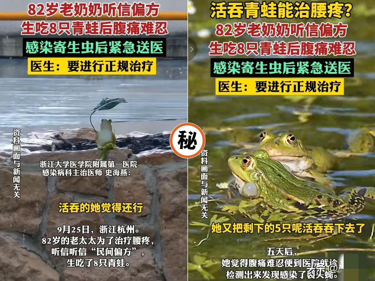 又是一个狠人！
 
杭州82岁阿婆为治腰疼，竟蹲池塘捉8只青蛙生吃，结果肚里钻出