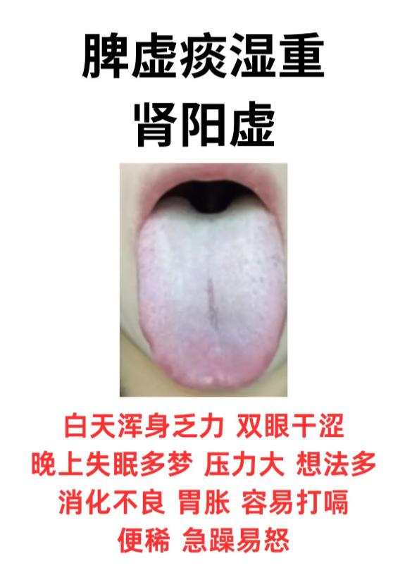 3 种脾肾亏虚舌象，辨证调理早改善