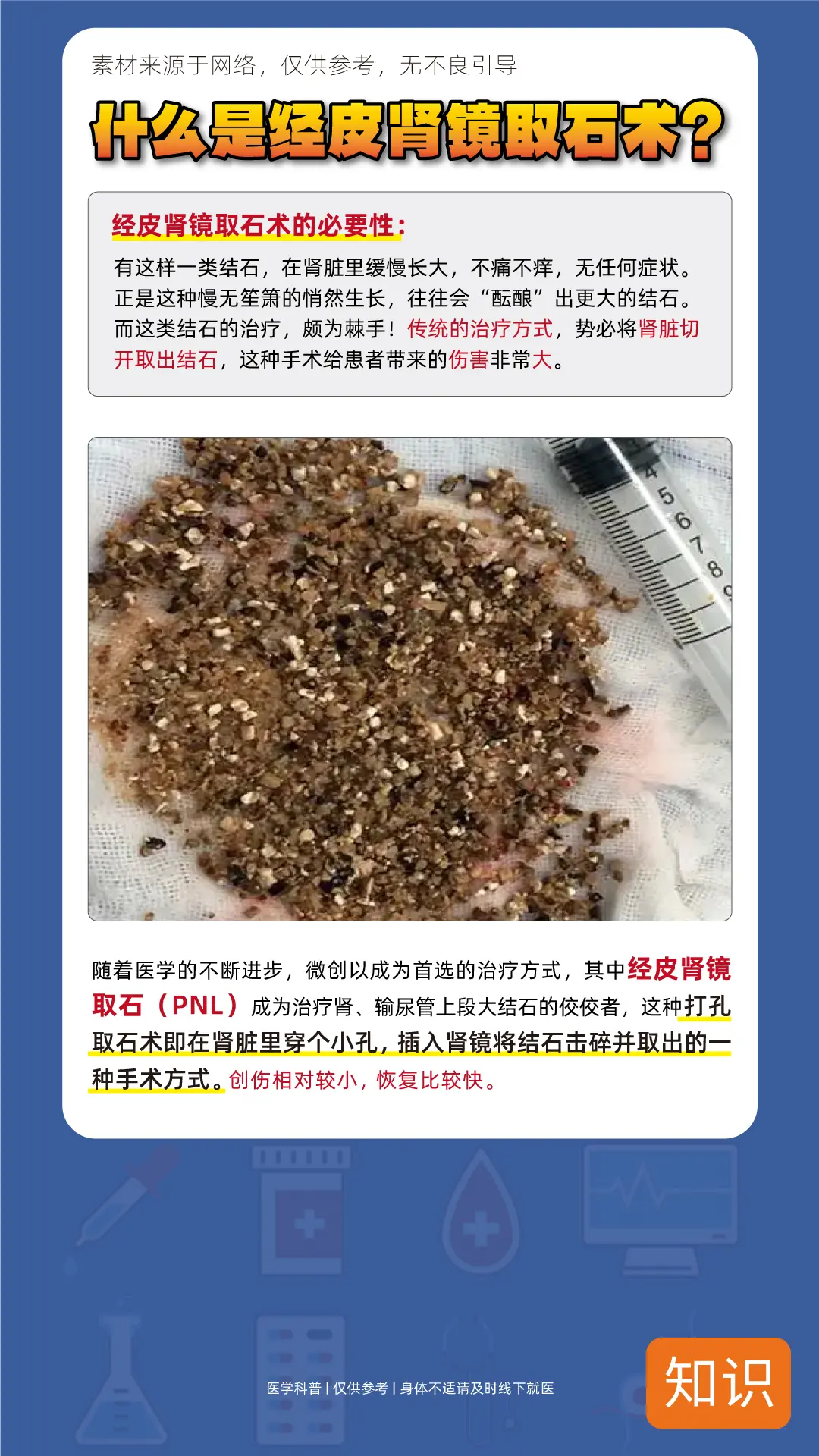 什么是经皮肾取石术？