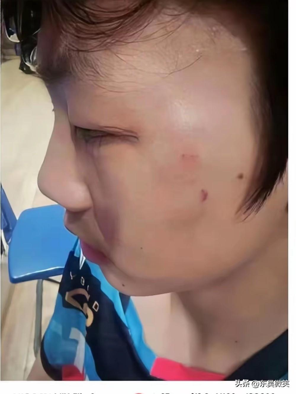 这就是被曹彦灏暴打的小运动员，赢了球却遭到一顿痛击，这又将给这位小运动员带来多大