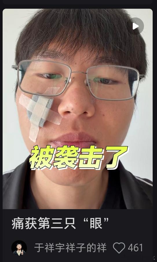 我怎么每次一刷到于祥宇就是他哪哪哪又受伤了，不好我的道德！不好我的笑点！ 
