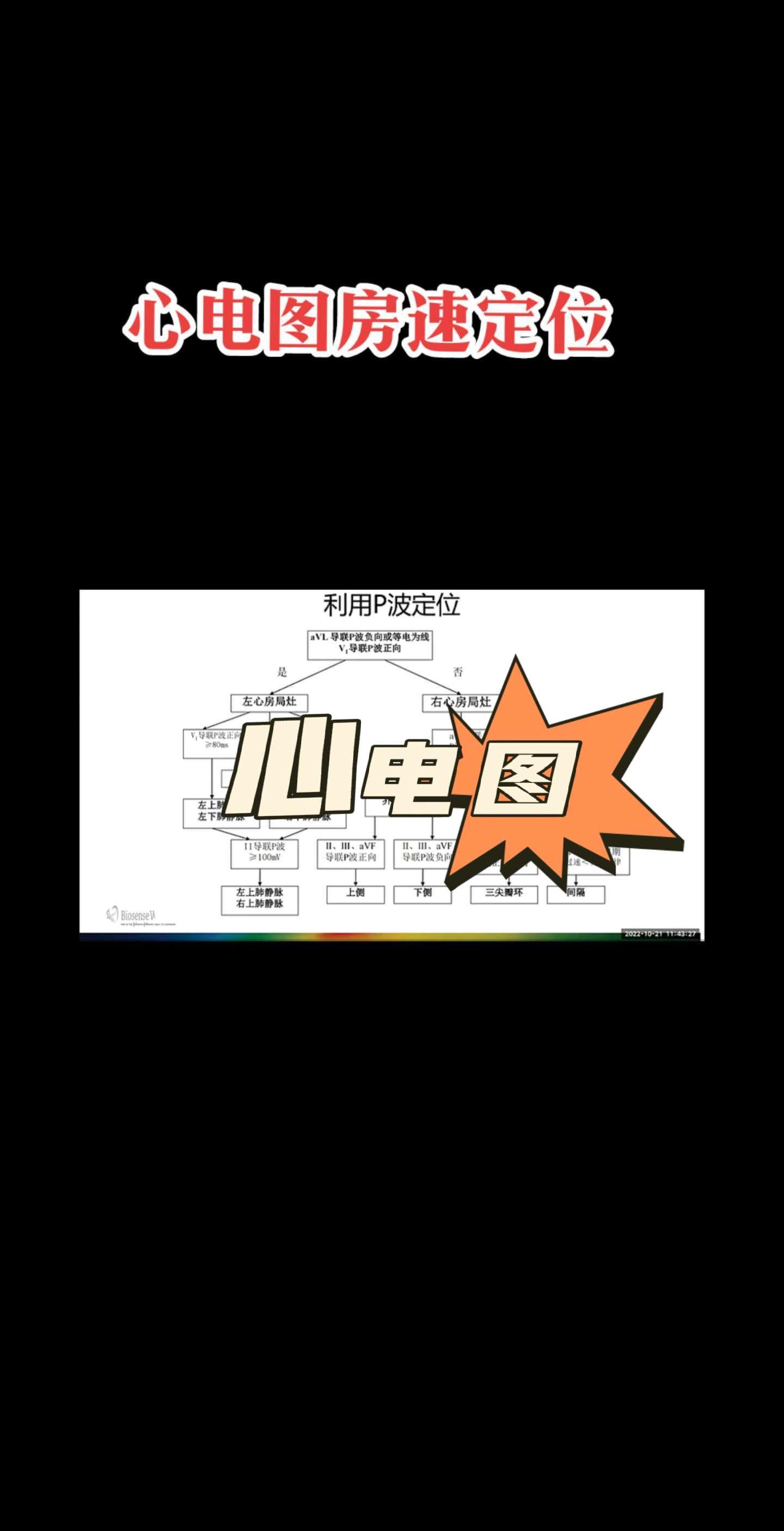 心电图 科普 心律失常
