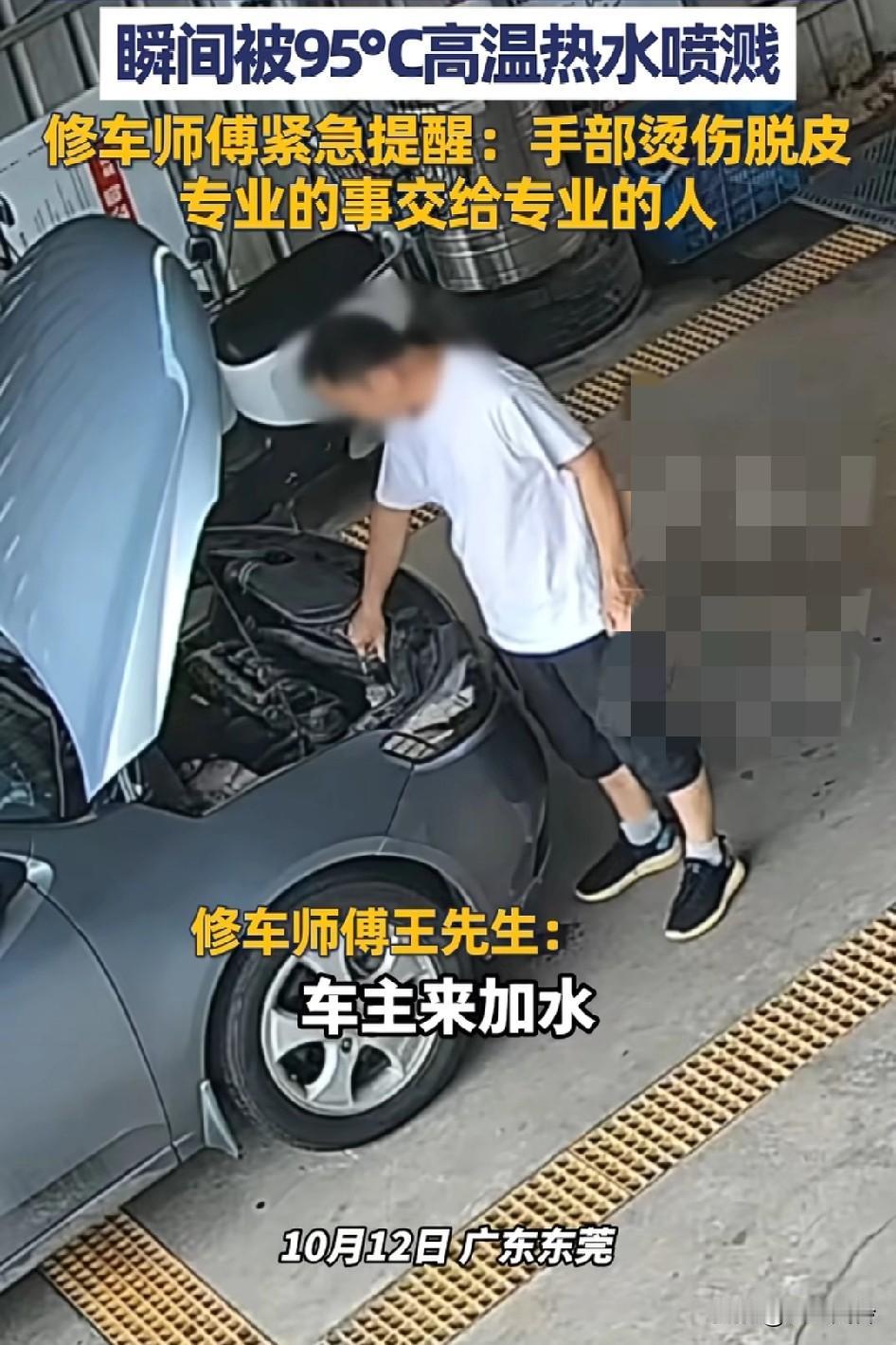 车主等待修车加水时竟擅自拧开车的水箱，95度高温热水瞬间喷溅，手上脸上都有烫伤