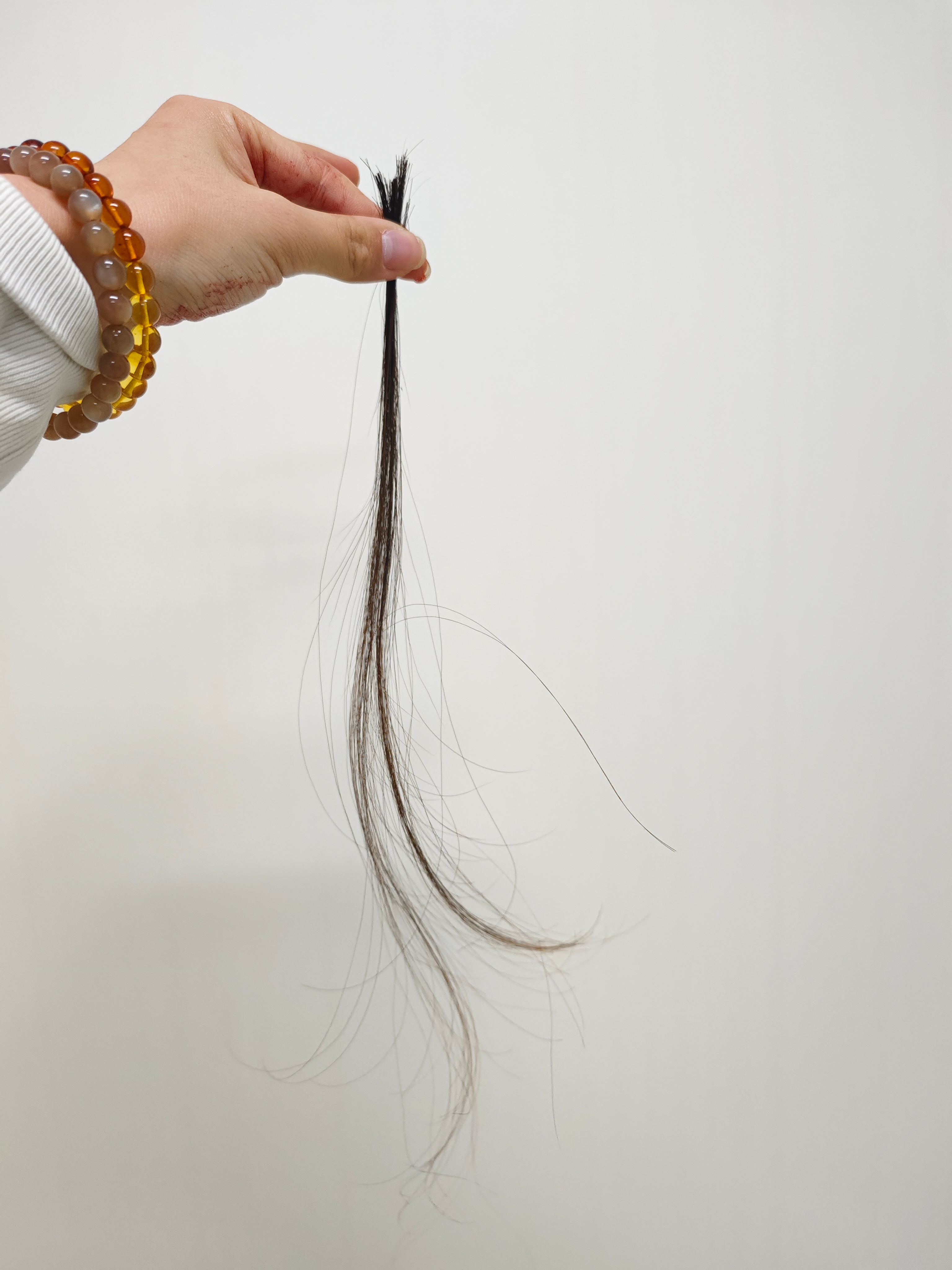 最近不是撞脑袋了来着，缝合伤口需要把伤口周围的头发剪了。说不心疼是假的，但还能过