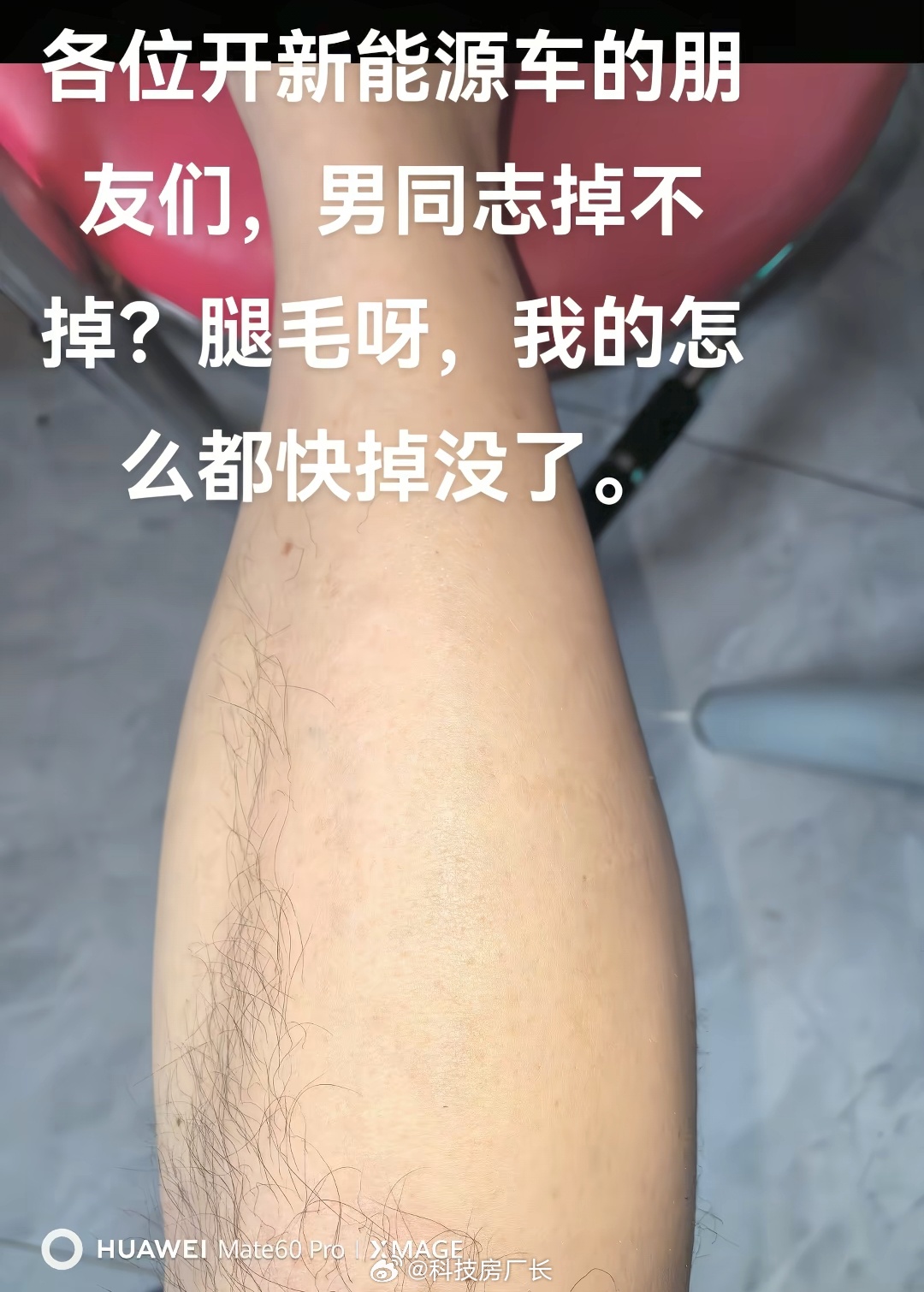 开电车掉腿毛到底是不是真的，有没有新能源车主出来说一说？ 