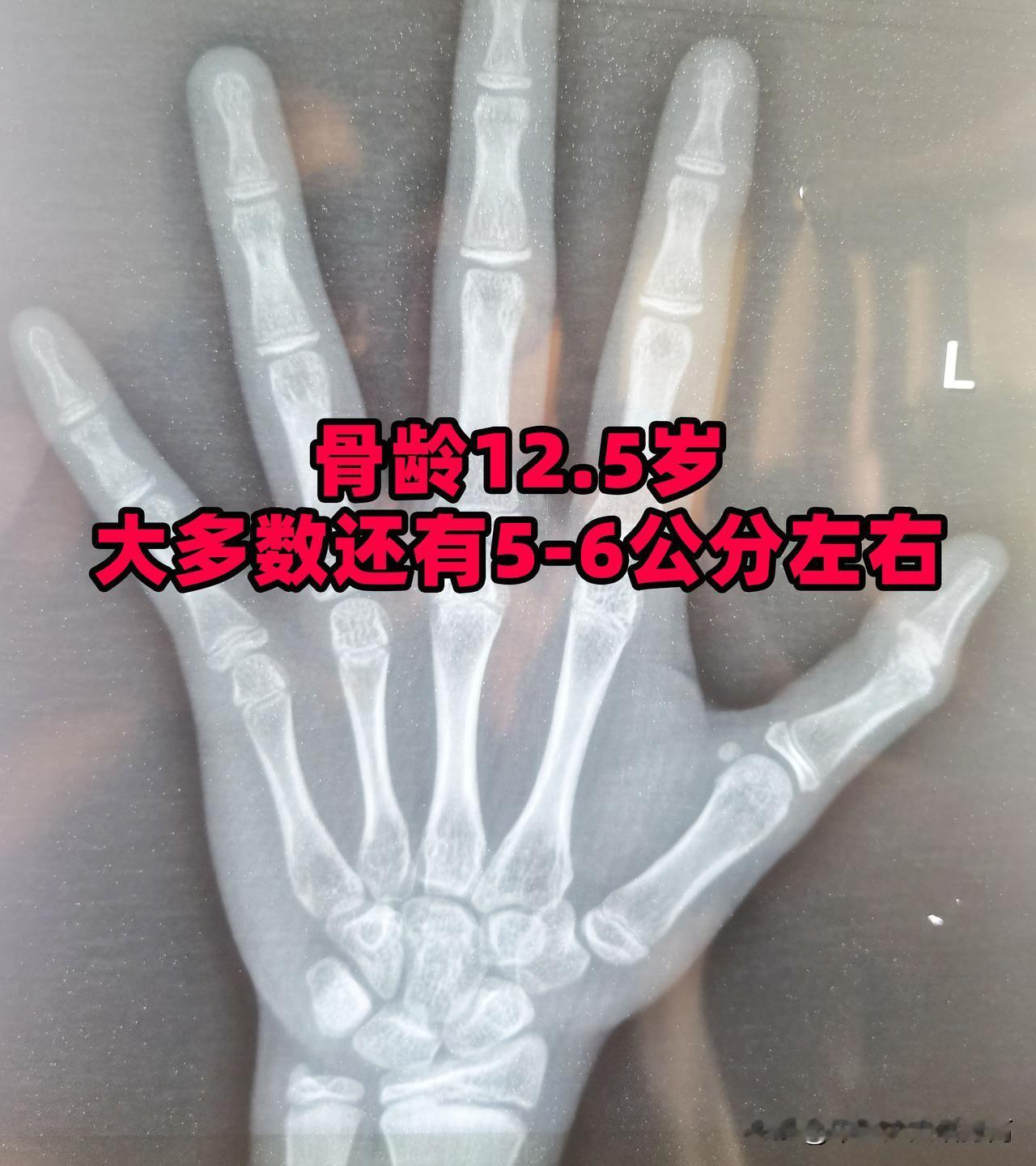 女孩到这个年龄没有155，就大概率长不到平均个了
 
如果你家是女孩，记住这时间