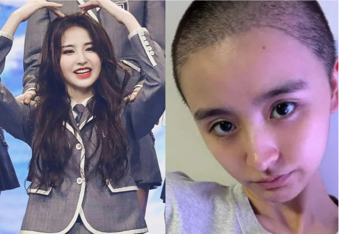 金子涵说的事情我很同情她，但逻辑太不正常了她一反抗（心情波动？）就头痛，有没有可