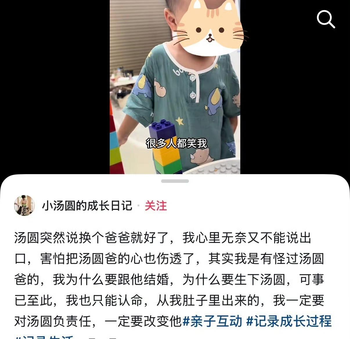 遗传眼病孩子问为什么要生我
四川小男孩“汤圆”遗传父亲的小睑裂综合征，这病让他眼
