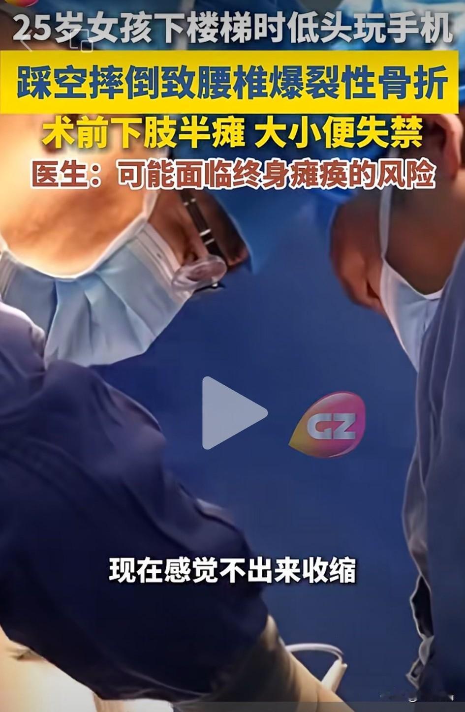 健康毁在手机上，人生毁在手机上。25岁女孩下楼梯时低头玩手机，踩空摔倒致腰椎爆裂