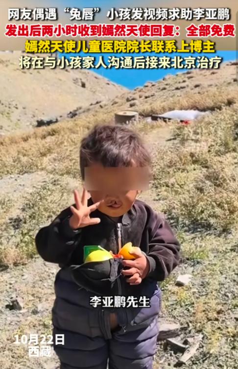 这才是互联网最该有的样子。
 
一名网友在西藏旅行时，偶遇一个唇腭裂小朋友，情急