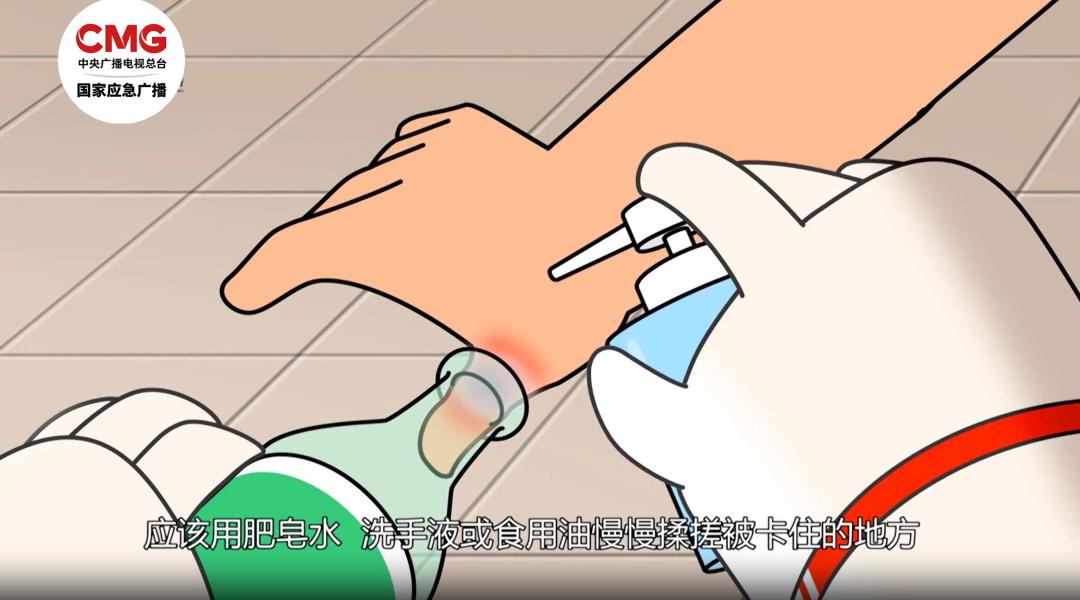 厨房这个地方利如刀片，手不要伸进去！