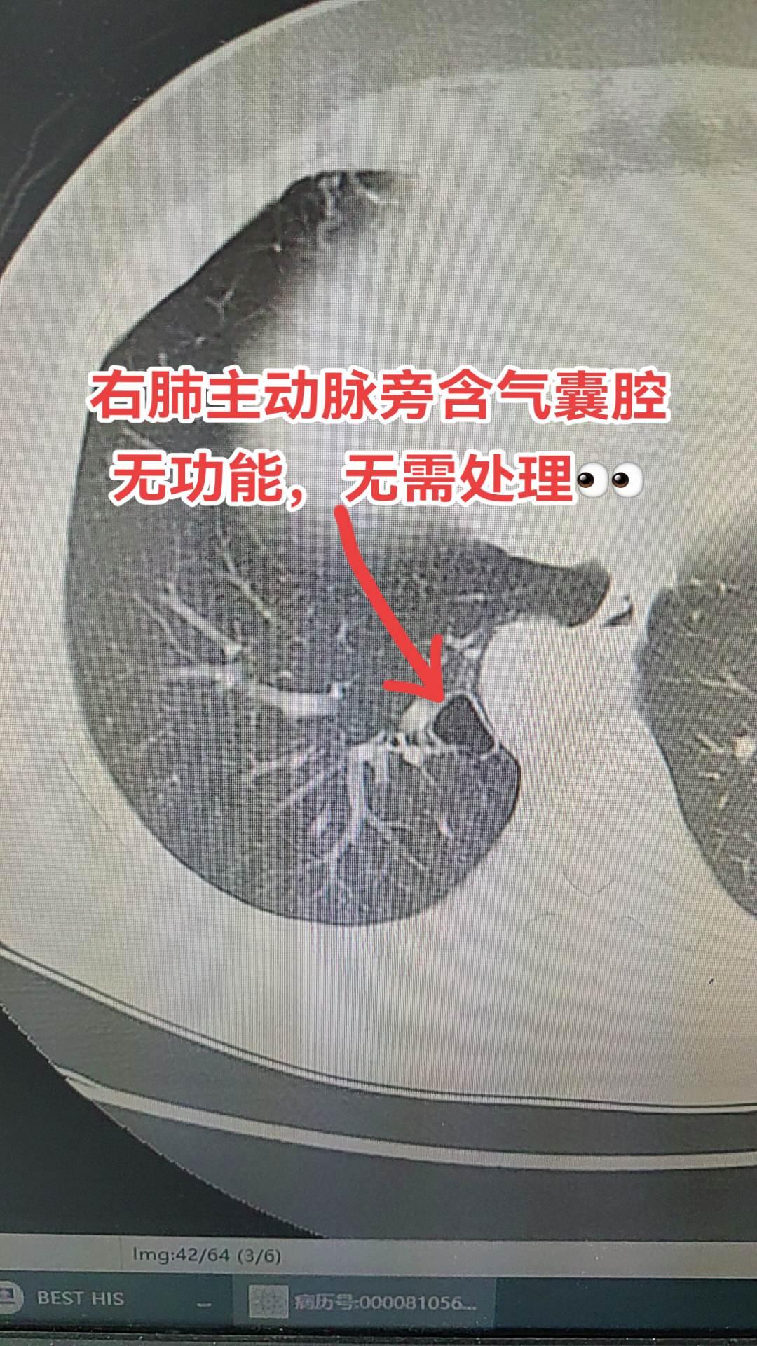 医学科普 医学影像 医生日常 医路前行 每天跟我涨知识